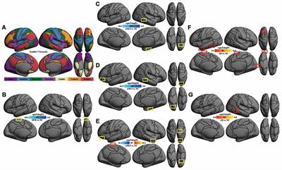 Functional Connectivity Changes Across the Spectrum of Subjective Cognitive Decline, Amnestic Mild Cognitive Impairment and Alzheimer’s Disease